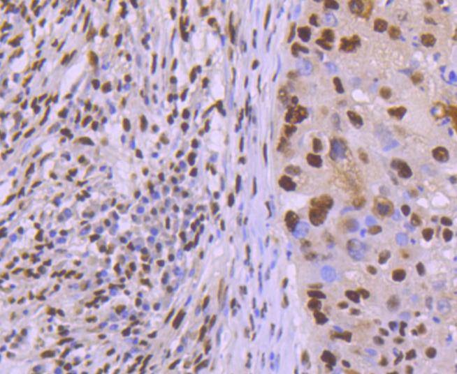 Anti-KAP1 Antibody (4I621)