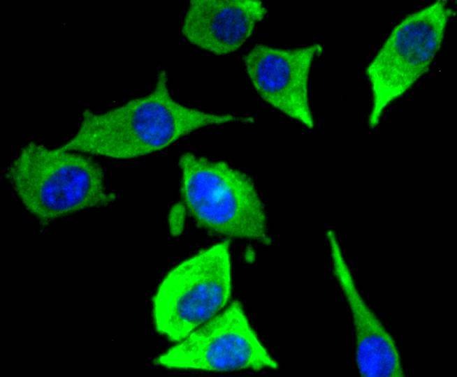 Anti-MAPK10 Antibody (7M343)