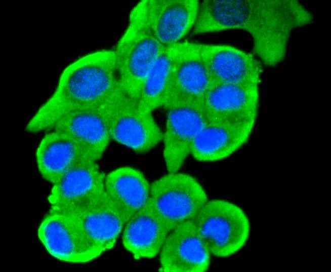 Anti-JNK2 Antibody (7P337)