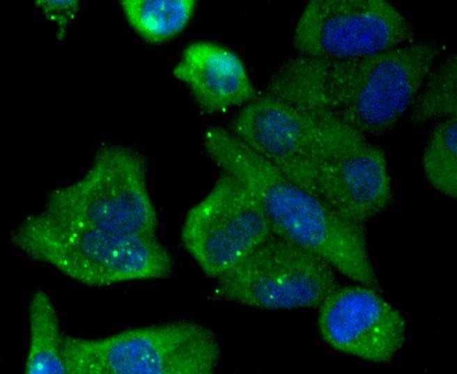 Anti-JNK2 Antibody (7P337)