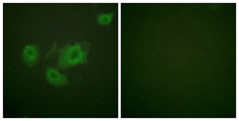Anti-Phospho-Kir6.2 (Thr224) Polyclonal Antibody