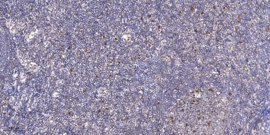 Anti-Phospho-JDP-2 (Thr148) Polyclonal Antibody