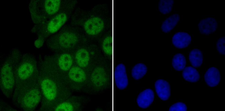 Anti-KAT8 Antibody (7Z632)