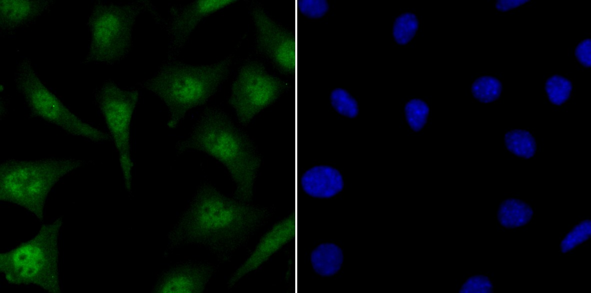 Anti-KAT8 Antibody (7Z632)