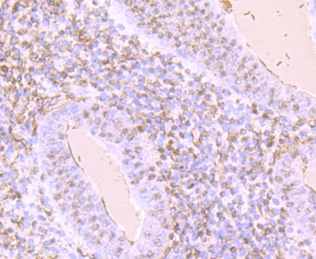 Anti-TIM-1/KIM-1/HAVCR1 Antibody (1N213)