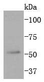 Anti-MAPK10 Antibody (7M343)