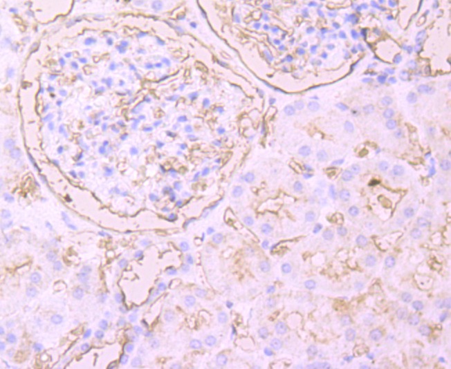 Anti-TIM-1/KIM-1/HAVCR1 Antibody (1N213)