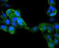 Anti-IRF6 Antibody (5K34)