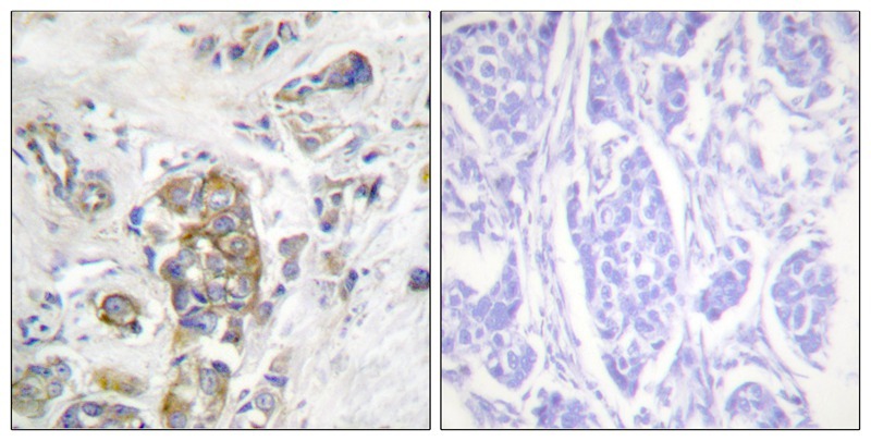 Anti-Phospho-ITGB4 (Tyr1510) Polyclonal Antibody