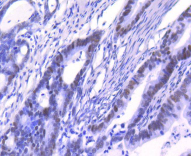 Anti-XRCC5 Antibody (9O180)
