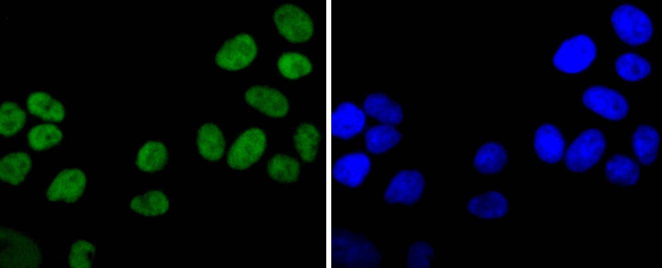 Anti-XRCC5 Antibody (9O180)