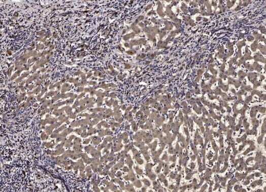 Anti-Phospho-IRF3 (Ser396) Polyclonal Antibody 2