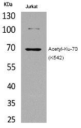 Anti-Acetyl-Ku70 (Lys542) Polyclonal Antibody
