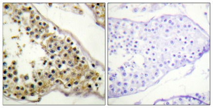 Anti-Phospho-ITK (Tyr512) Polyclonal Antibody