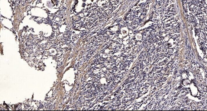 Anti-Phospho-IRF7 (Ser471, 472) Polyclonal Antibody 2