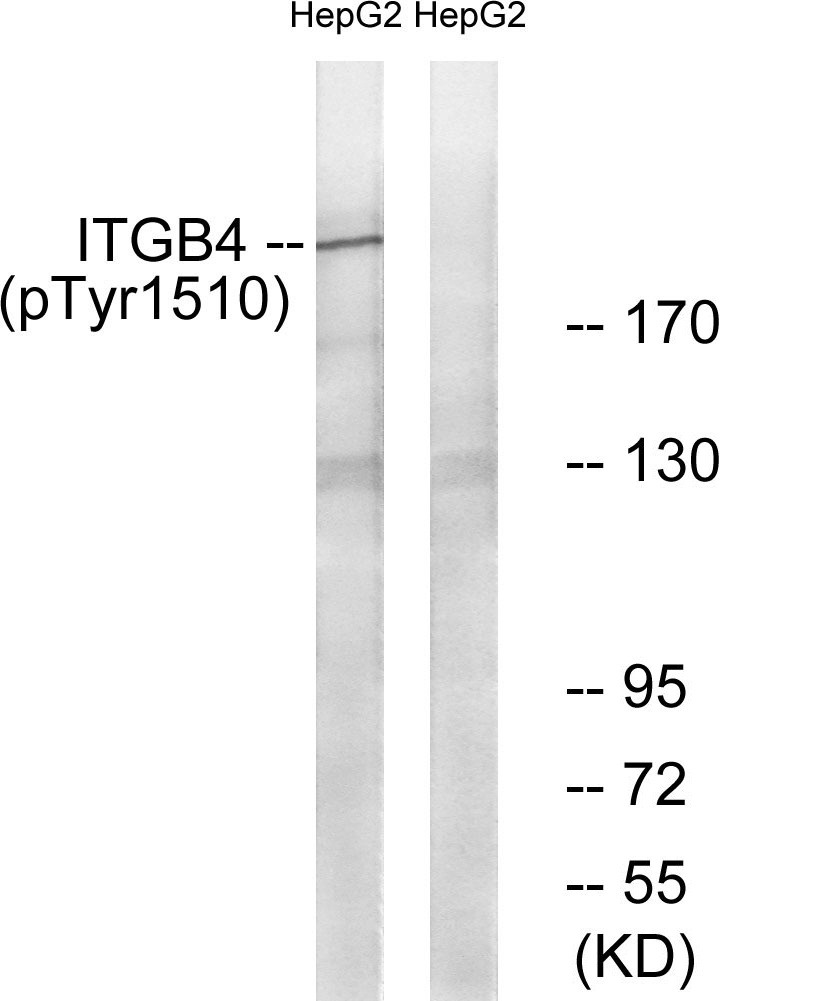 Anti-Phospho-ITGB4 (Tyr1510) Polyclonal Antibody