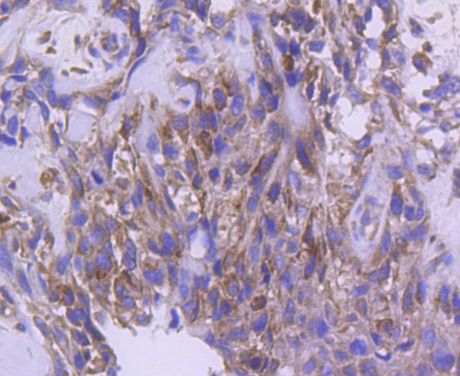 Anti-IRF5 Antibody (6F756)