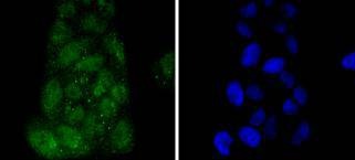Anti-IRF3 Antibody (3T220)