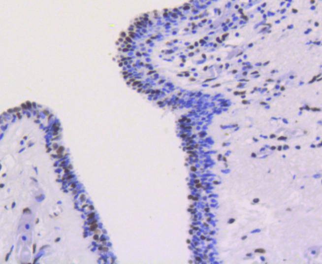 Anti-XRCC5 Antibody (9O180)