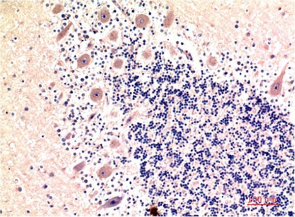 Anti-MAP1LC3B Antibody (9I491)