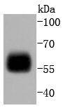 Anti-IRF5 Antibody (2A61)