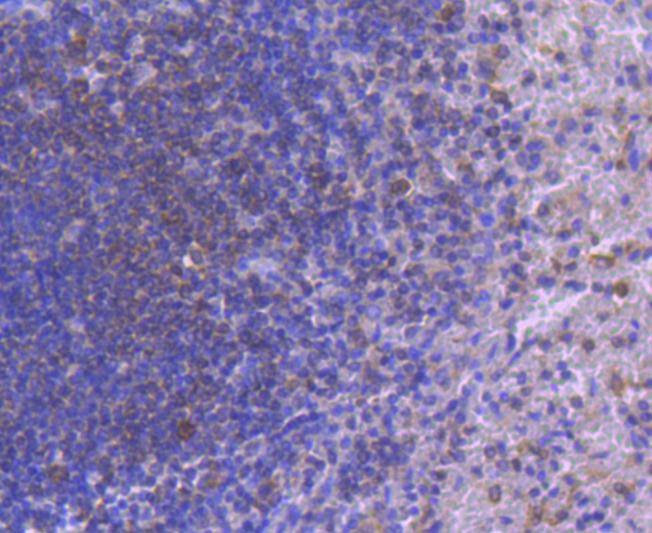 Anti-IRF5 Antibody (2A61)