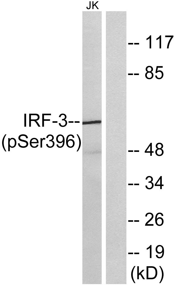 Anti-Phospho-IRF3 (Ser396) Polyclonal Antibody 2