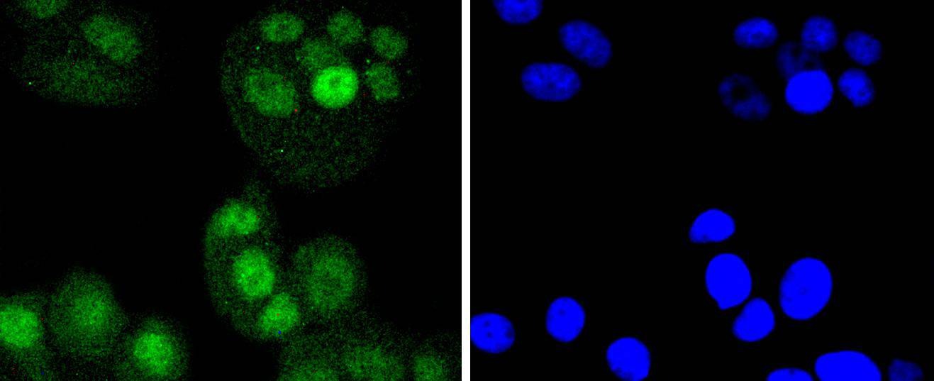 Anti-IRF6 Antibody (5K34)