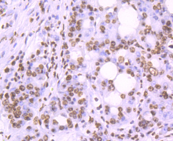 Anti-H2AFX Antibody (1G393)