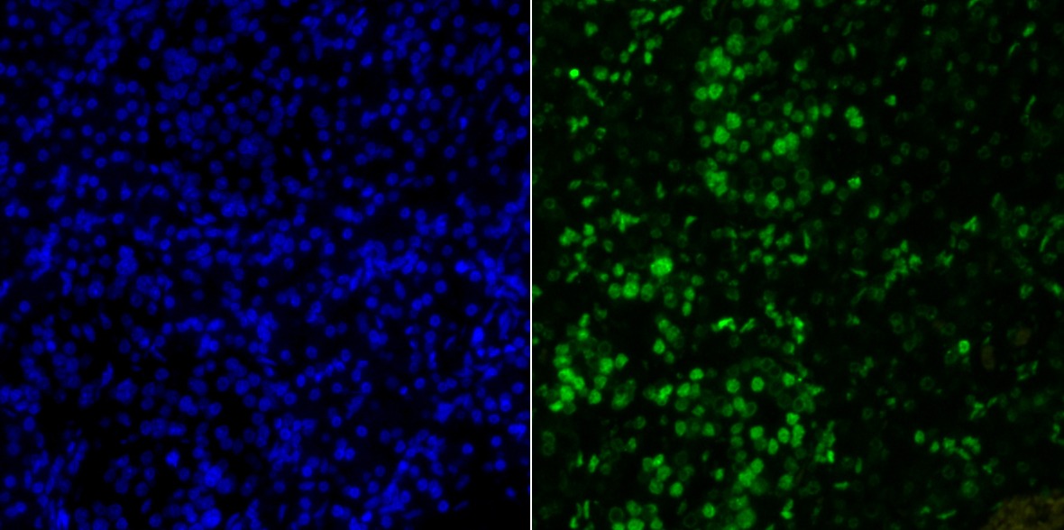 Anti-H2AFX Antibody (1G393)
