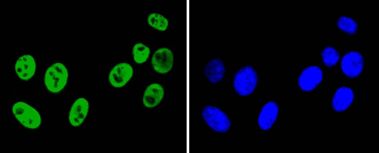 Anti-HNRNPK Antibody (5Q710)