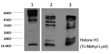 Anti-Tri-methyl-HIST1H3A (Lys9) Antibody (5M584)