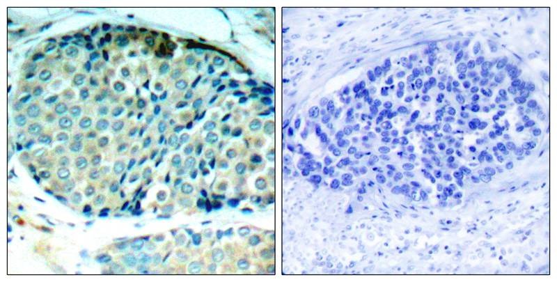Anti-Phospho-Hsp27/HSPB1 (Ser78) Polyclonal Antibody