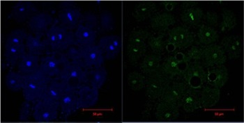 Anti-HIST1H3A Antibody (5H508)