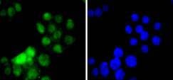 Anti-HNF4A Antibody (1Y813)