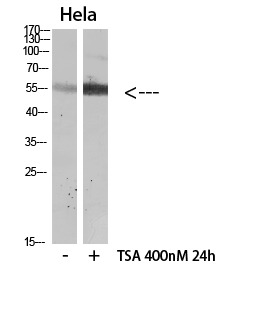 Anti-Acetyl-HNF4A (Lys106) Polyclonal Antibody