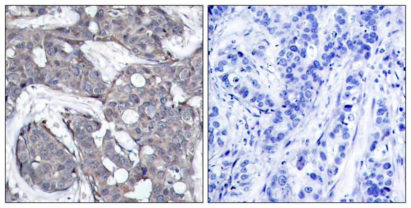Anti-Phospho-Hsp27/HSPB1 (Ser82) Polyclonal Antibody