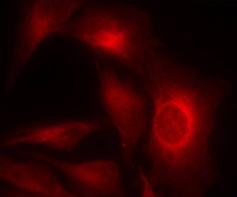 Anti-Phospho-Hsp27/HSPB1 (Ser15) Polyclonal Antibody