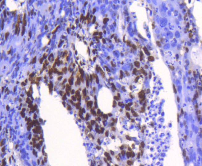 Anti-HNRNPK Antibody (5Q710)