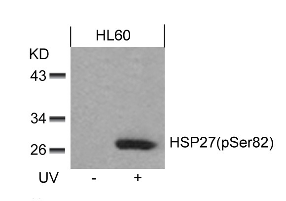 Anti-Phospho-Hsp27/HSPB1 (Ser82) Polyclonal Antibody