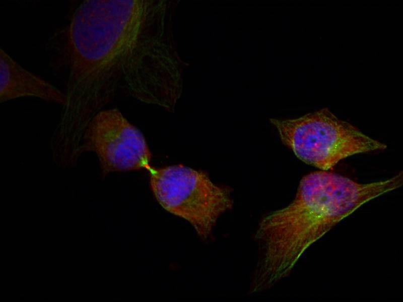 Anti-Phospho-Hsp27/HSPB1 (Ser78) Polyclonal Antibody