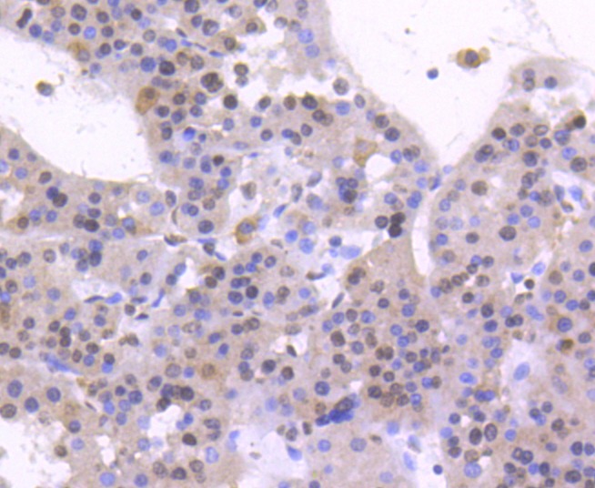 Anti-HNF4A Antibody (1Y813)