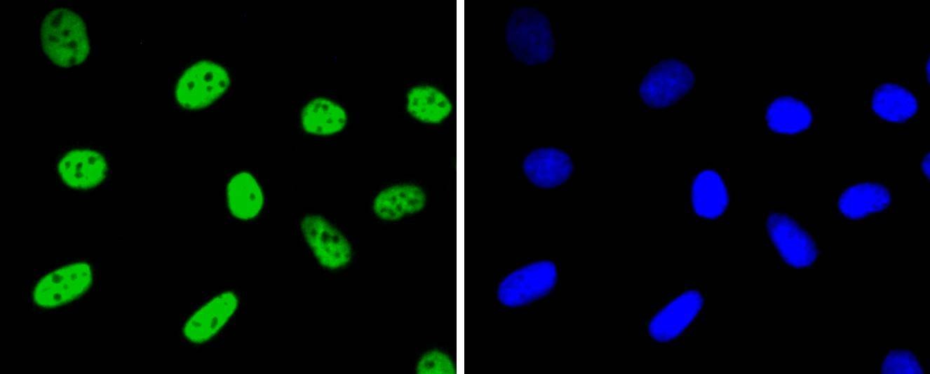 Anti-HNRNPK Antibody (5Q710)