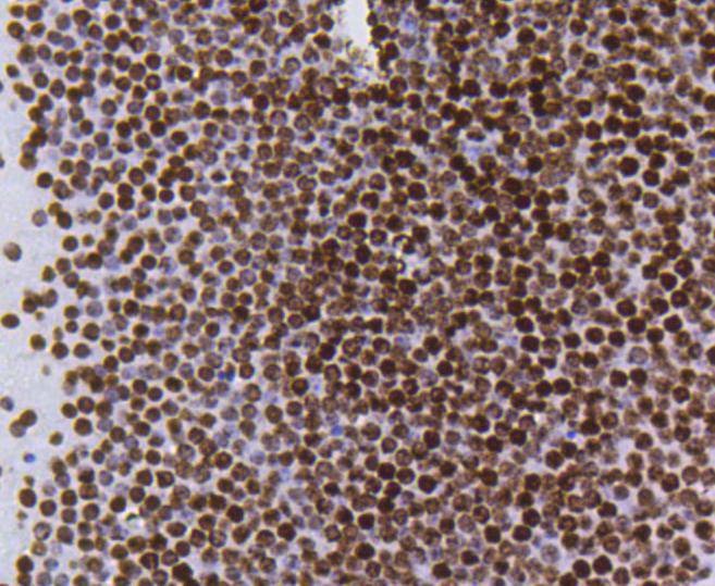 Anti-Acetyl-Histone H4 (Lys5) Antibody (9C227)