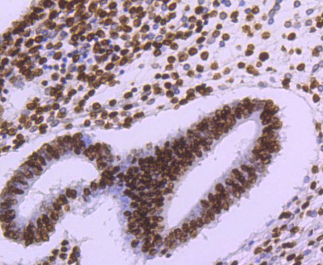 Anti-HIST1H3A Antibody (5X651)