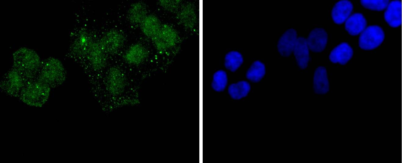 Anti-HIST1H3A Antibody (5X651)