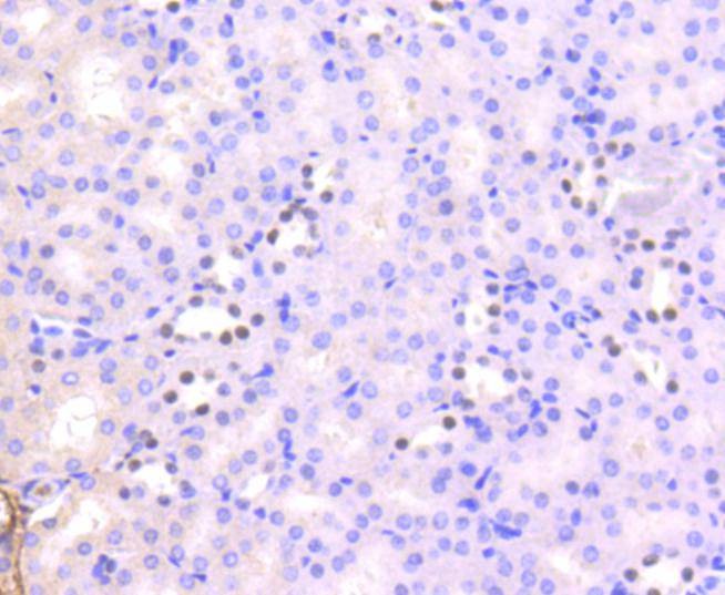 Anti-Acetyl-HIST1H3A (Lys56) Antibody (4S839)