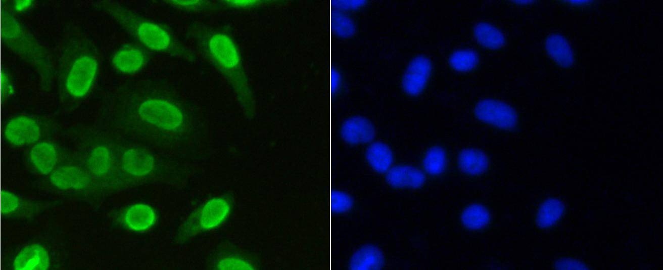 Anti-Mono-methyl-HIST1H3A (Lys36) Antibody (1Z792)