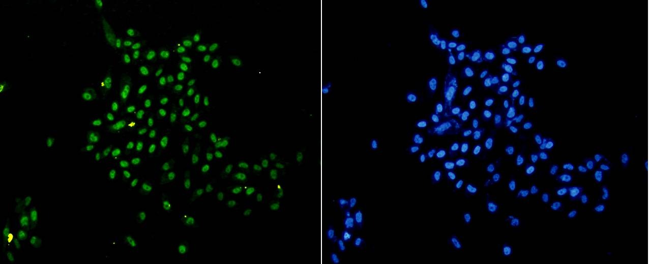 Anti-Mono-methyl-HIST1H3A (Lys18) Antibody (6Y799)