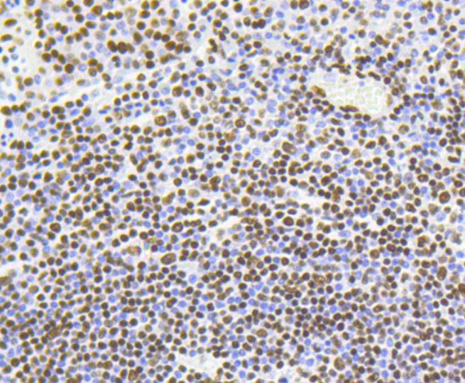 Anti-Acetyl-Histone H4 (Lys5) Antibody (9C227)
